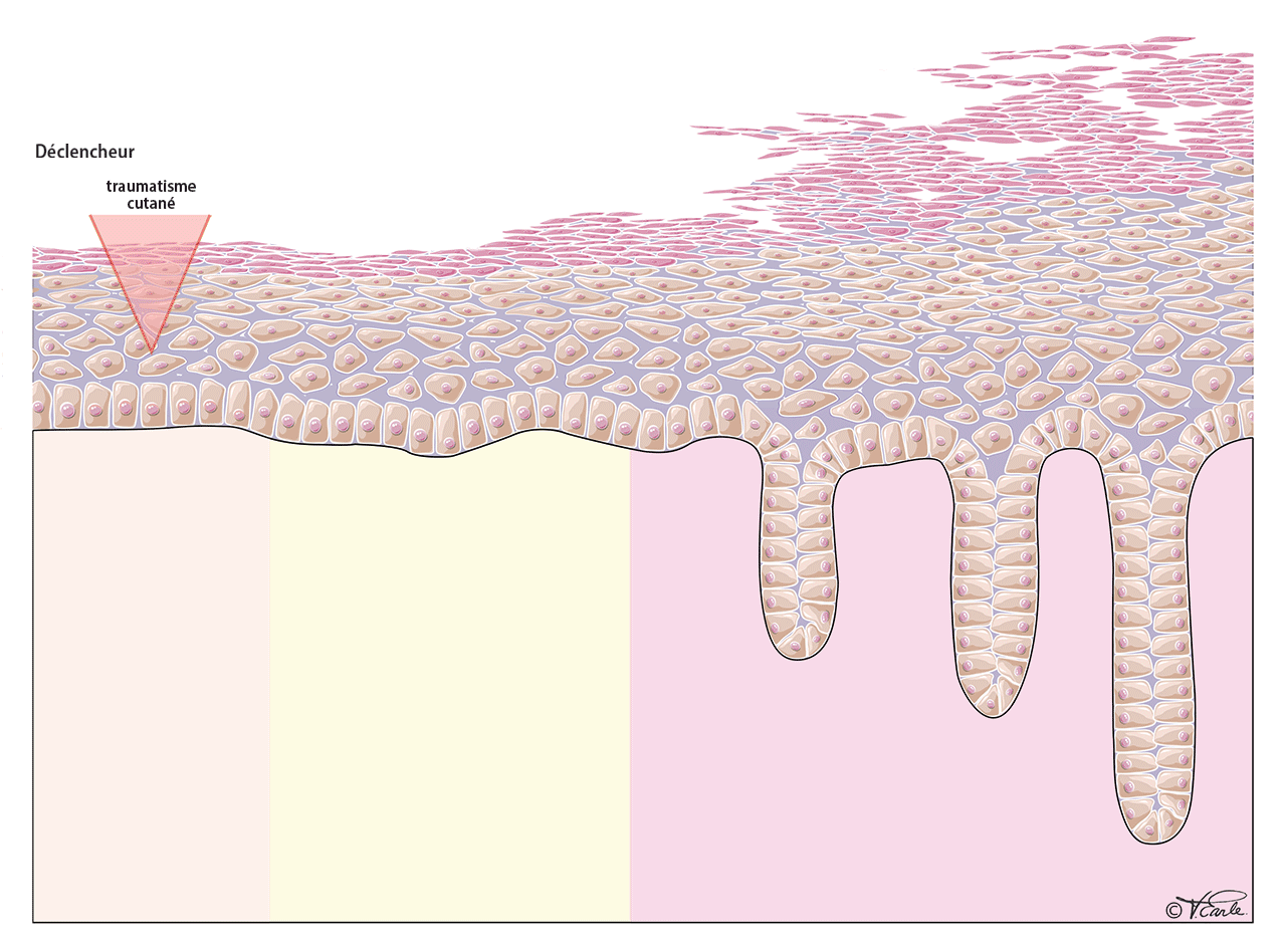 Fig. 3 Psoriasis Cycle Final FR