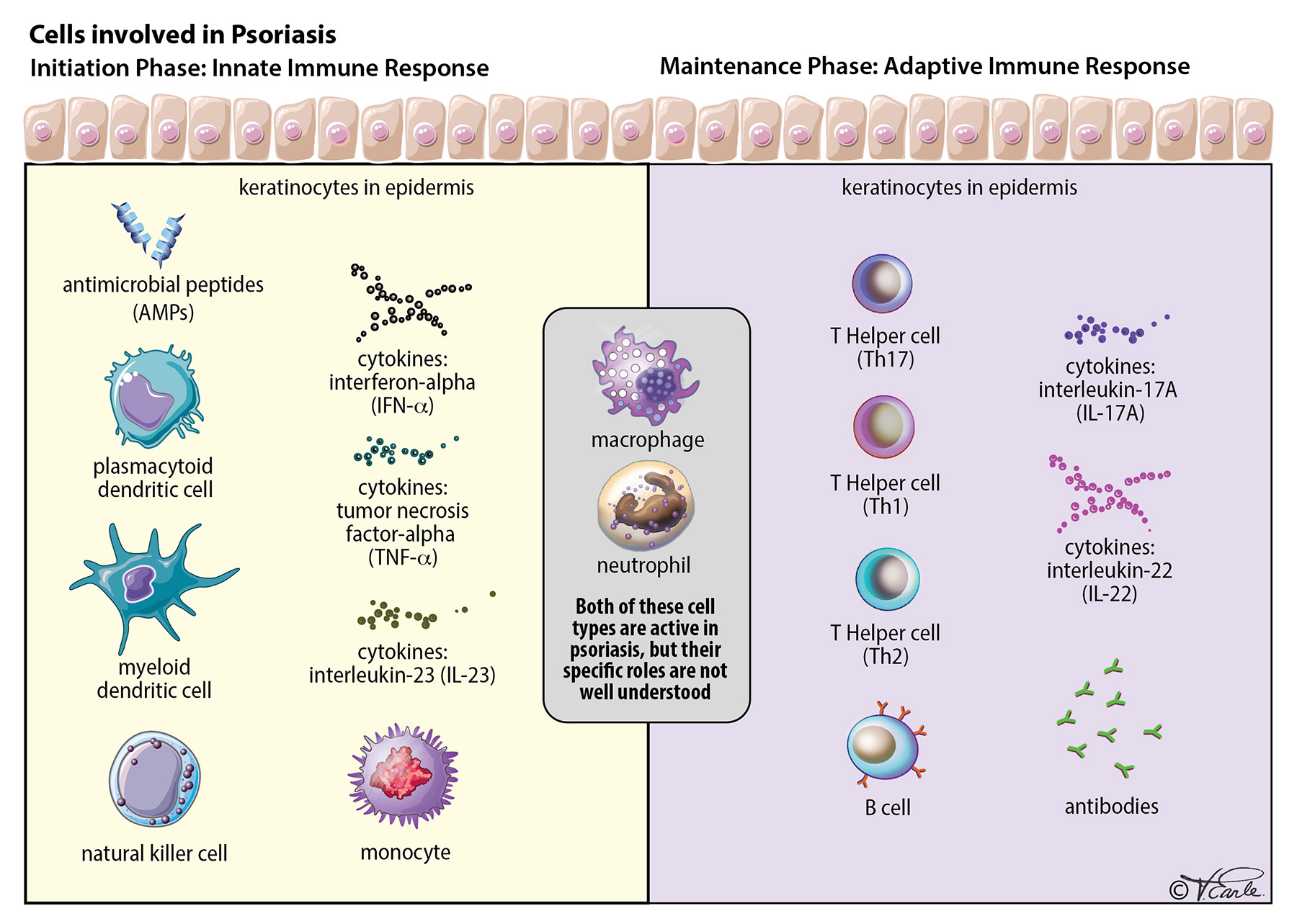 What Causes Psoriasis interactive