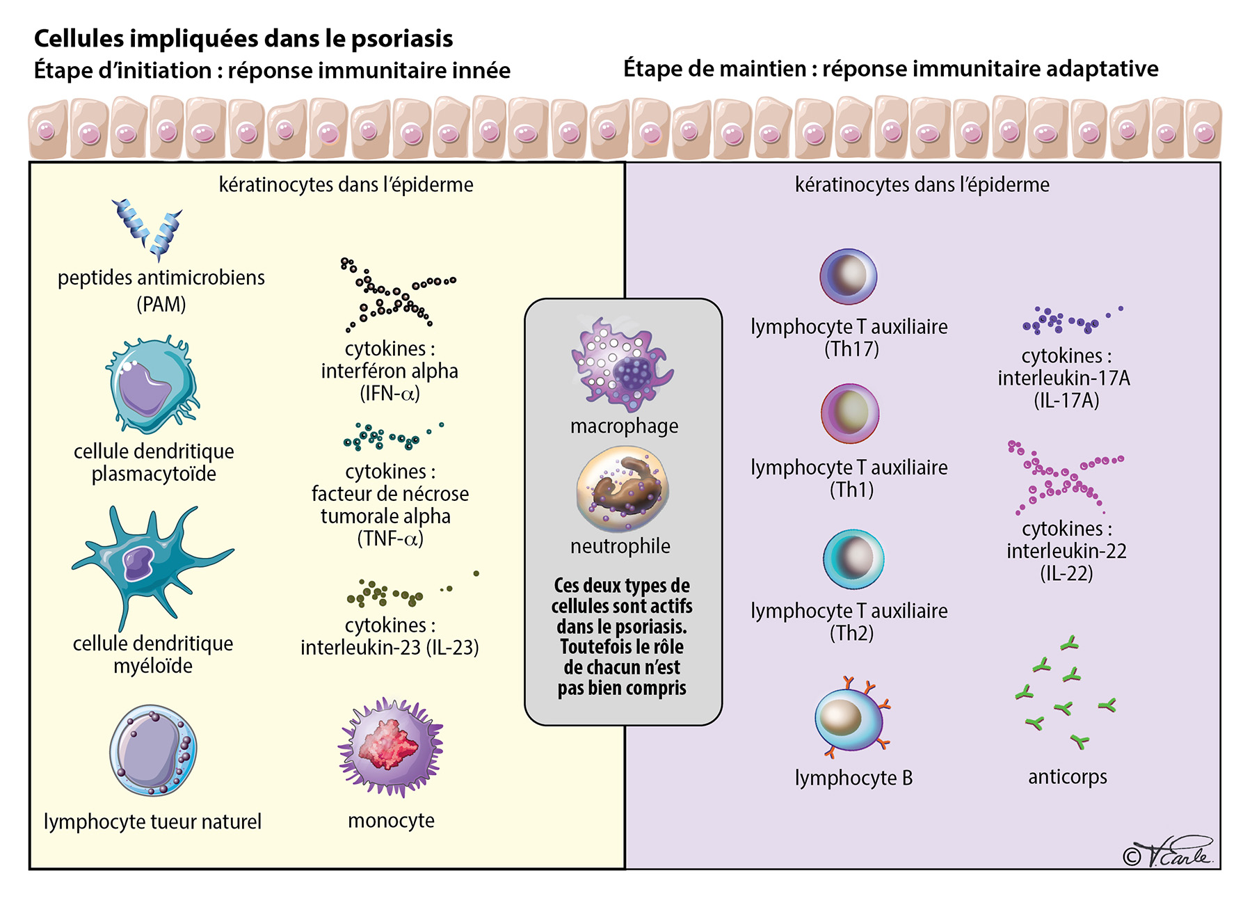 What Causes Psoriasis interactive FR